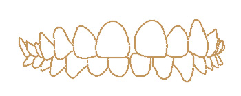 Gapped teeth illustration