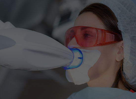 Advanced expertise for aligner treatment